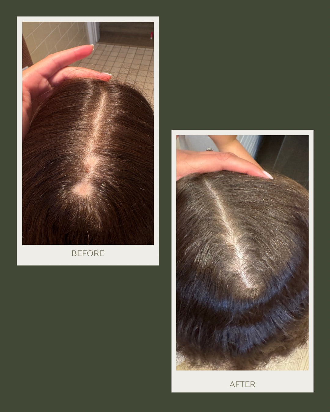 Scalp Elixir