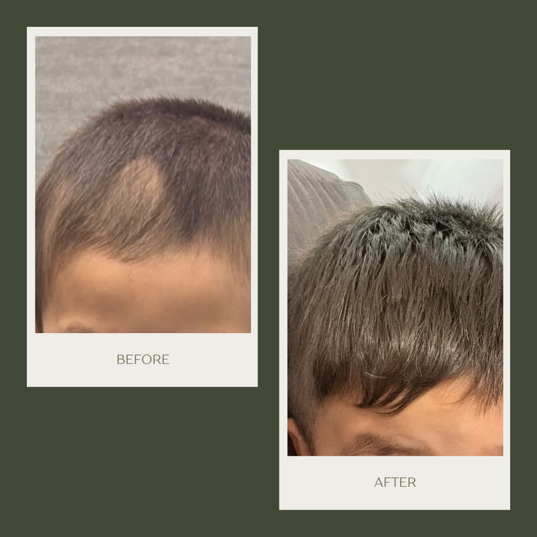 Kids Hair Growth Oil